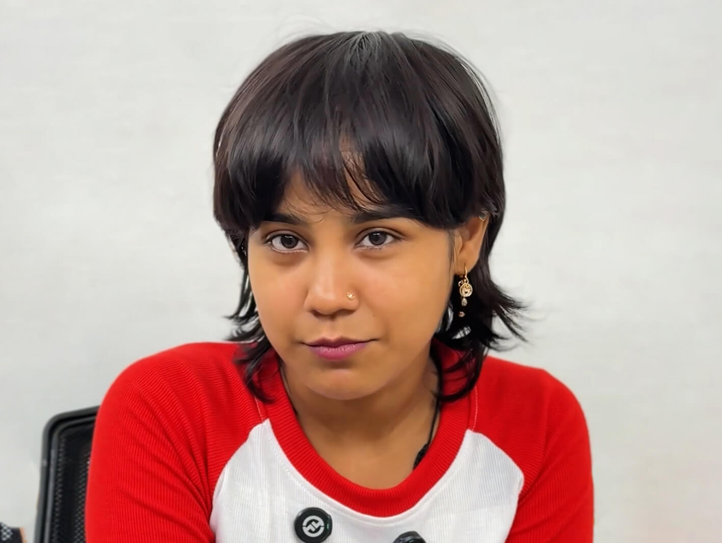 Female hair transplant before after